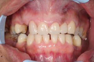 Img 6201 w1myos - Eugenol