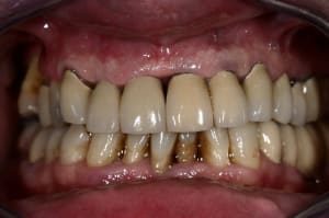 Img 6290 hjdzpw - Eugenol