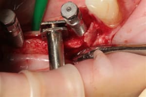 Img 6355 m5p8l6 - Eugenol