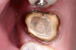 Img 7279 ll6yey - Eugenol