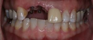 Img 7279 quqvfk - Eugenol