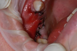 Img 7362 ctutil - Eugenol