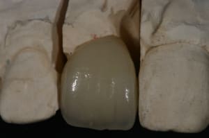 Img 7568 meqxja - Eugenol