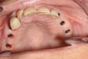 Img 7572 balqmx - Eugenol