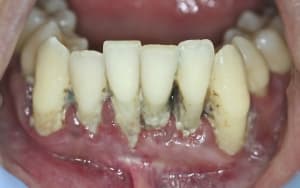 Img 7680 ttttez - Eugenol