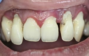 Img 7681 ldvxbu - Eugenol