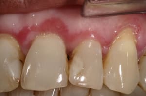 Img 7795 gcswqk - Eugenol