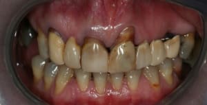 Img 8321 iptdyf - Eugenol