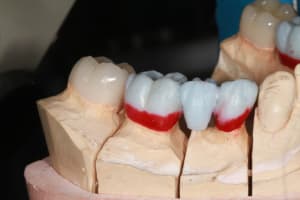 Img 8789 mklvdh - Eugenol