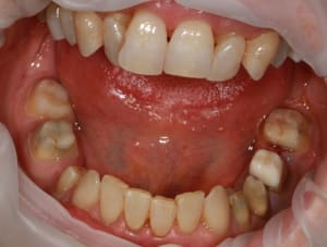 Img 8797 vc8ar9 - Eugenol