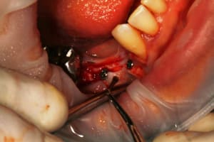 Img 8839 p7b1ht - Eugenol