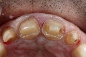 Img 9165 xzs1lx - Eugenol