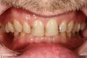 Img 9257 lz7zgv - Eugenol