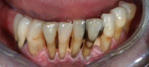 Img 9278 fdurhi - Eugenol