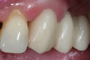 Img 9343 nhukoz - Eugenol
