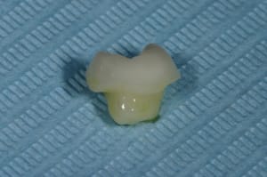 Img 9540 rm3dxz - Eugenol