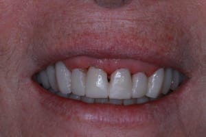 Img 9540 tdw9hu - Eugenol