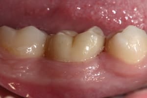 Img 9639 xuq6et - Eugenol