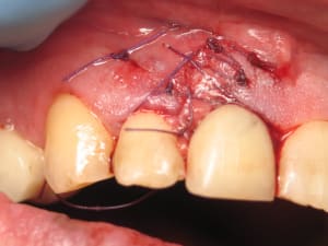 Img 9766 b795pd - Eugenol