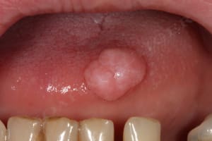 Img 9915 czfv9r - Eugenol