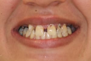 Img 9997 002 rajxwv - Eugenol