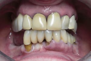 Iniface ui9rgr - Eugenol