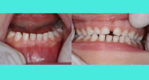 Image 2 ykh7q8 - Eugenol