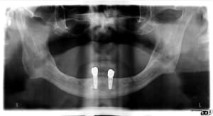 Image000  2  fg5zv0 - Eugenol