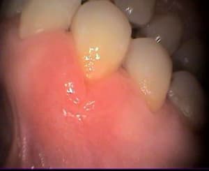 Image000 hingfe - Eugenol
