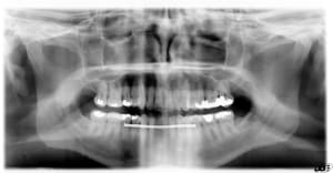 Image000 tuoumx - Eugenol