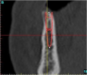 Image13 ad5egp - Eugenol