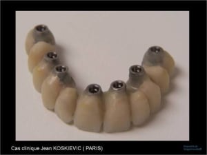 Image19 i6ssrw - Eugenol