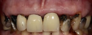 Image1 dojdzm - Eugenol