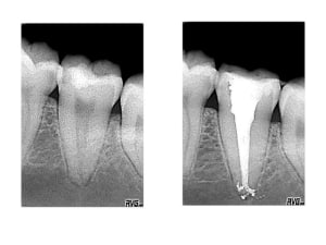 Image2 ootcpb - Eugenol
