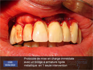 Image33 lgpyfl - Eugenol