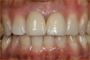 Image3 a1dufr - Eugenol