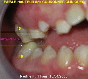 Image4 nsthlp - Eugenol