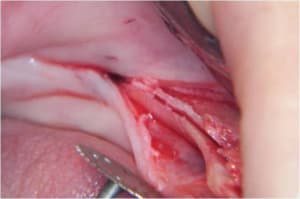 Image5 djpkgy - Eugenol