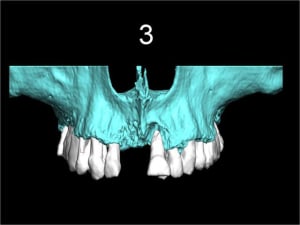 Image6 ehyeju - Eugenol