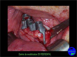 Image8 hbaokn - Eugenol