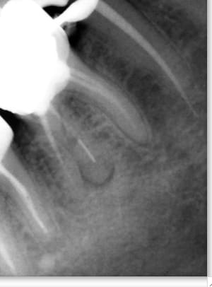 Image 1 zyeoev - Eugenol