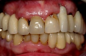 Img 1387 lexebb - Eugenol