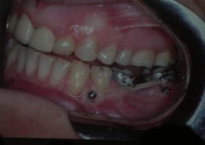 Img 1983 whjff8 - Eugenol