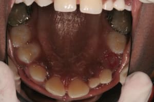 Img 3122 vxqfvm - Eugenol