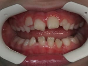 Img 3925 tdbet6 - Eugenol