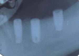 M.f - Eugenol