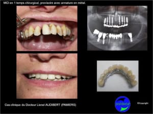Mci mise en charge imm diate 002 kwvdh6 - Eugenol