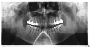 M 20041106 179 3 hytvfm - Eugenol