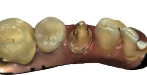 Mandibule 55 id85 xxz9fv - Eugenol