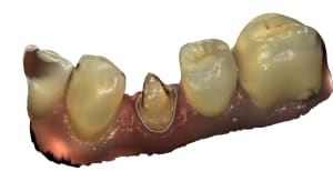 Mandibule 58 id85 alm6ur - Eugenol